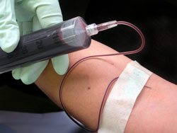 лечение рака крови в израиле