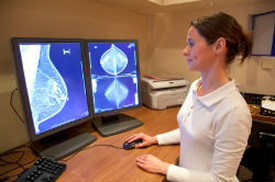 Маммография 3D в Израиле